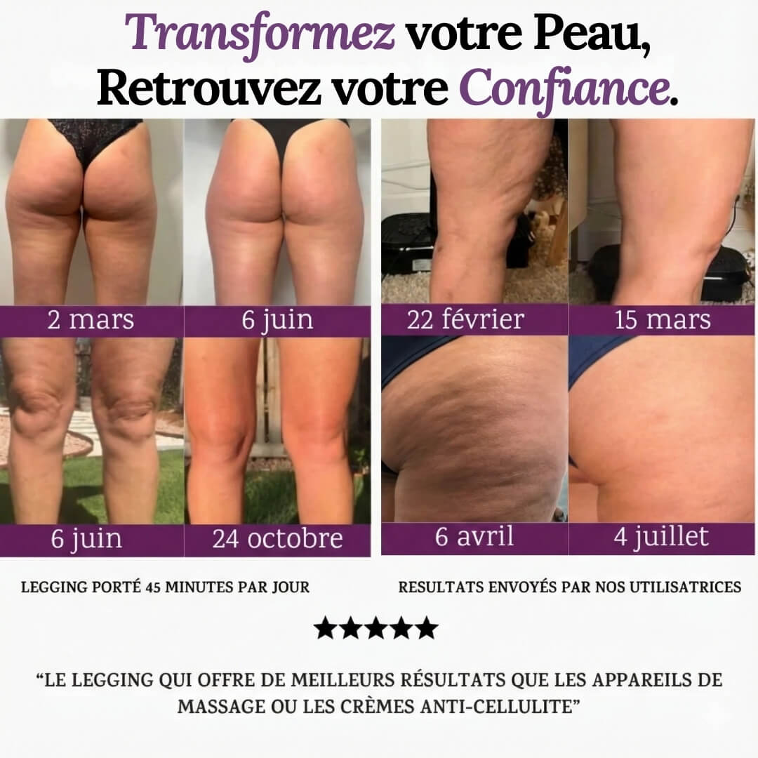 Short Sculptant 3D - Anti-Cellulite